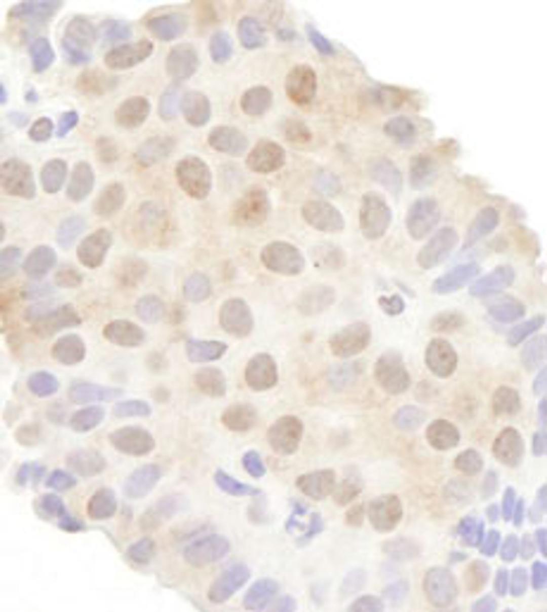 Detection of human DDX20 by immunohistochemistry.