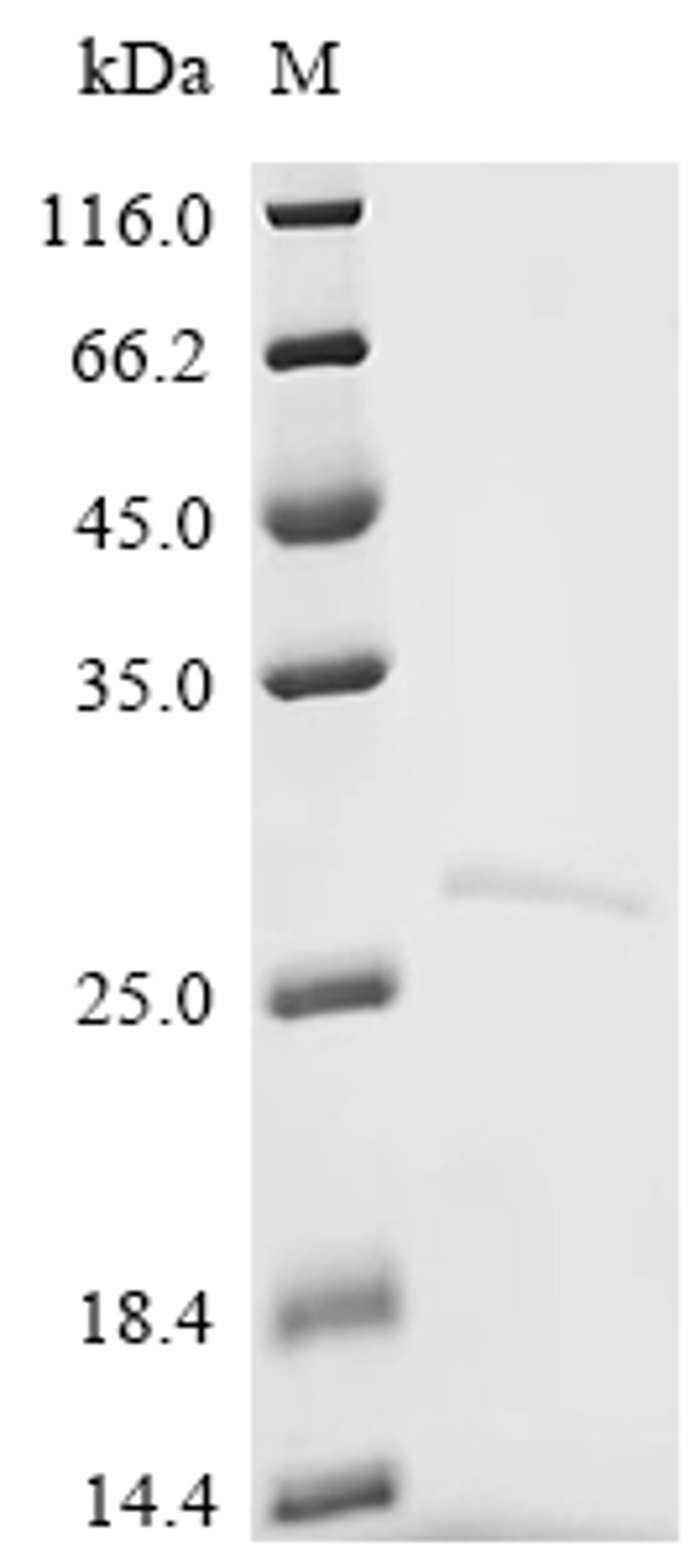 (Tris-Glycine gel) Discontinuous SDS-PAGE (reduced) with 5% enrichment gel and 15% separation gel.