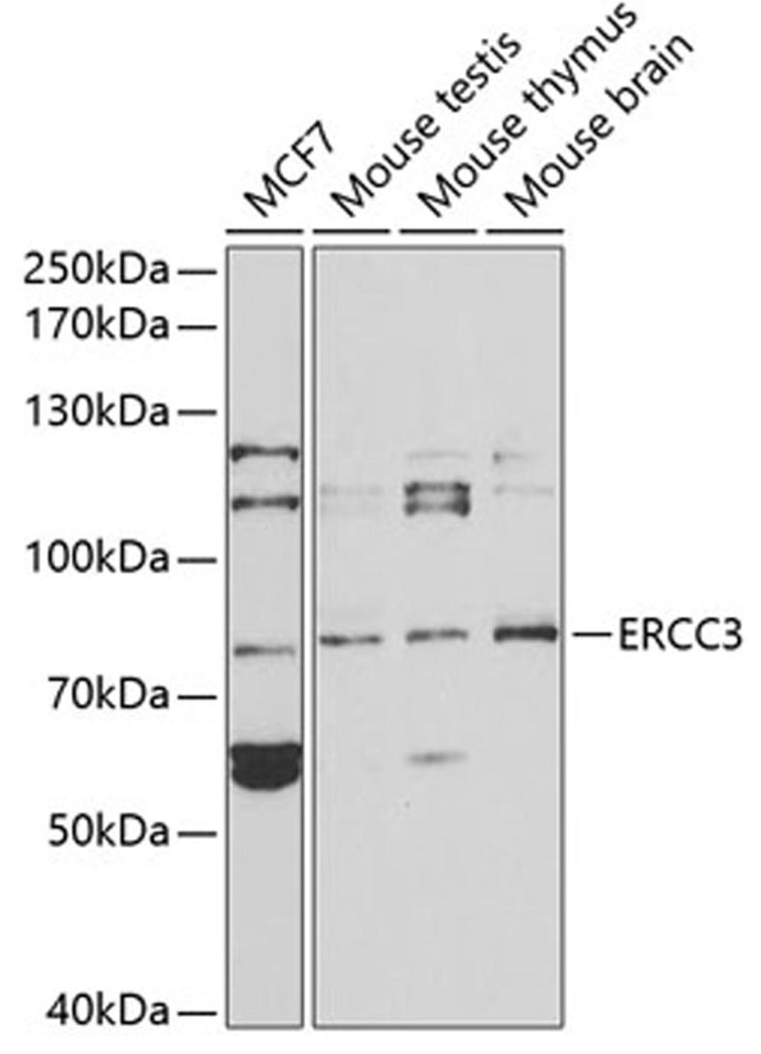 Western blot - ERCC3 antibody (A1714)