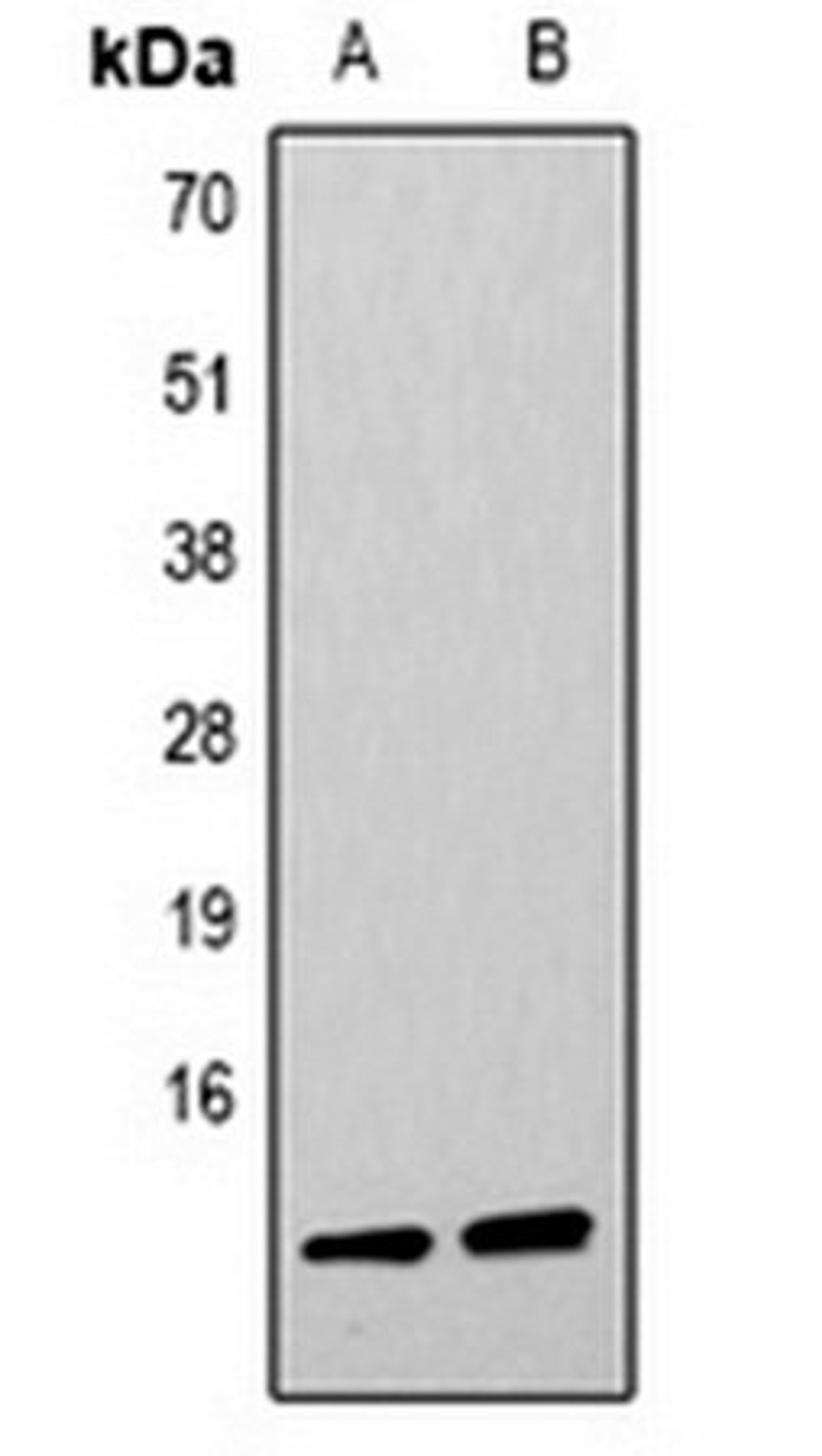 Western blot analysis of  Hela (Lane1), NIH3T3 (Lane2) whole cell lysates using Histone H4 (DiMethyl K59) antibody