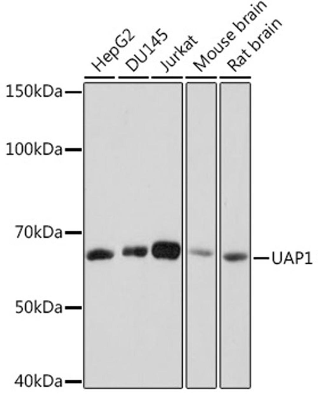 Western blot - UAP1 Rabbit mAb (A8662)