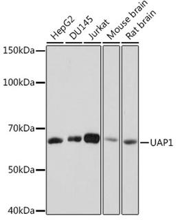 Western blot - UAP1 Rabbit mAb (A8662)