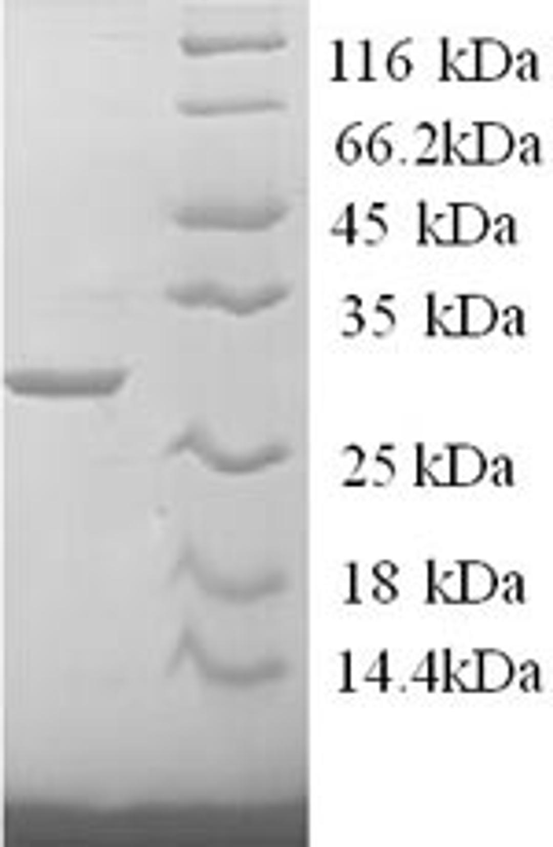(Tris-Glycine gel) Discontinuous SDS-PAGE (reduced) with 5% enrichment gel and 15% separation gel.