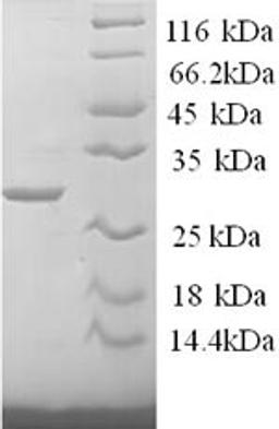 (Tris-Glycine gel) Discontinuous SDS-PAGE (reduced) with 5% enrichment gel and 15% separation gel.