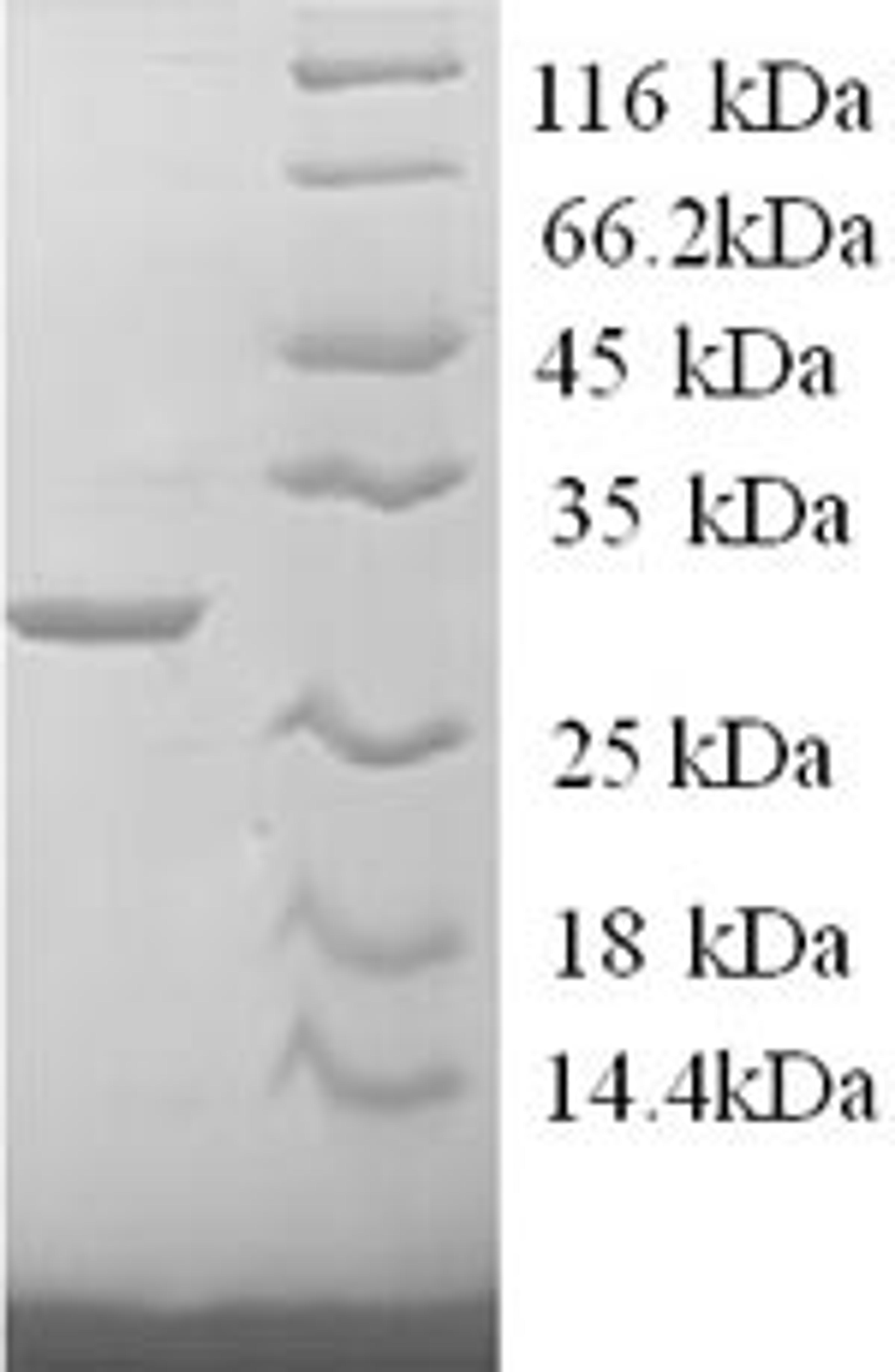 (Tris-Glycine gel) Discontinuous SDS-PAGE (reduced) with 5% enrichment gel and 15% separation gel.