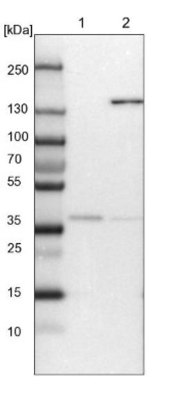 Western Blot: Cingulin Antibody [NBP1-89600] - Lane 1: NIH-3T3 cell lysate (Mouse embryonic fibroblast cells)<br/>Lane 2: NBT-II cell lysate (Rat Wistar bladder tumour cells)