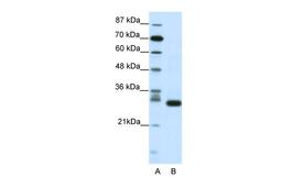 Antibody used in WB on Human Jurkat 1.25 ug/ml.