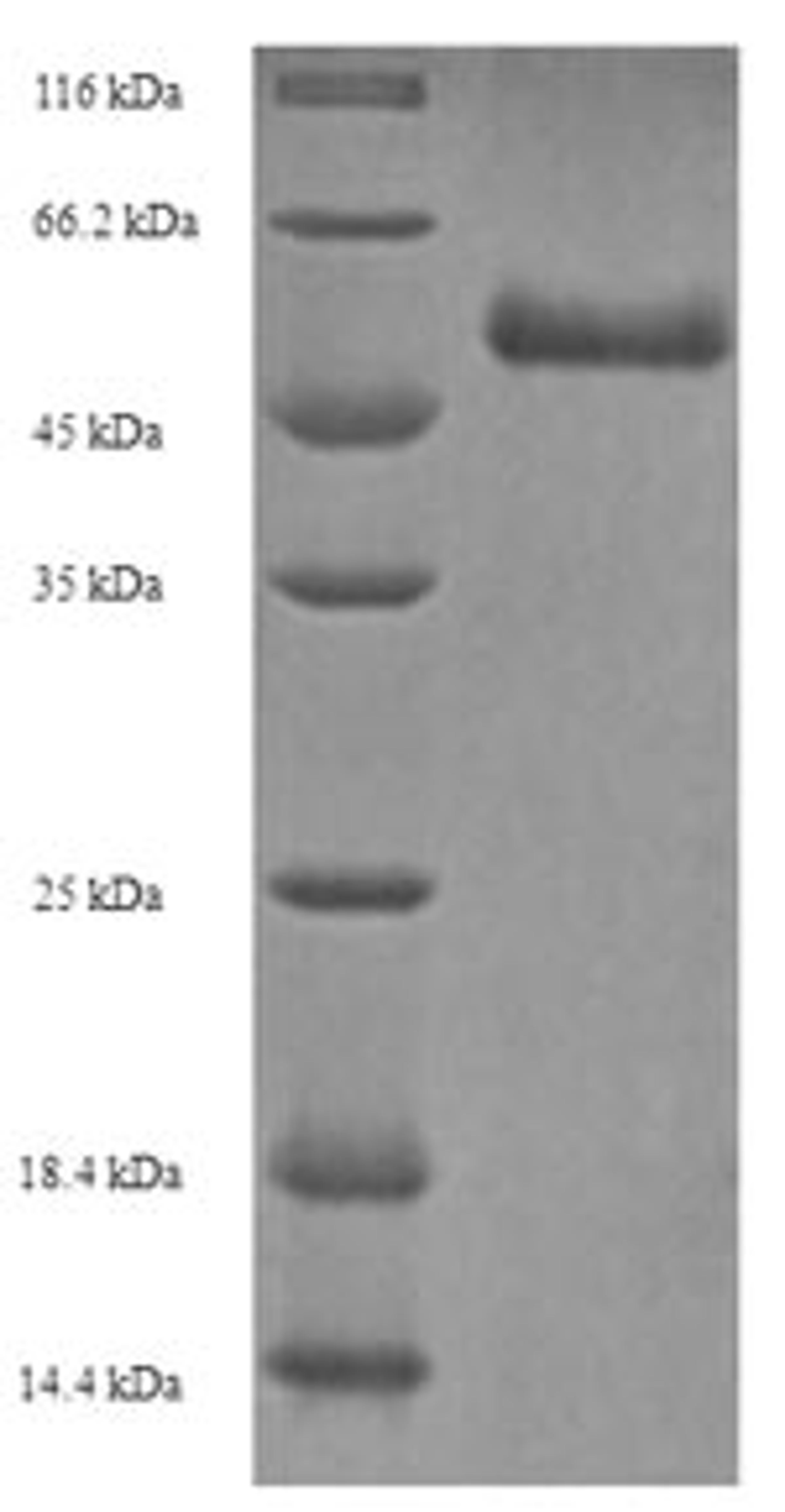 (Tris-Glycine gel) Discontinuous SDS-PAGE (reduced) with 5% enrichment gel and 15% separation gel.