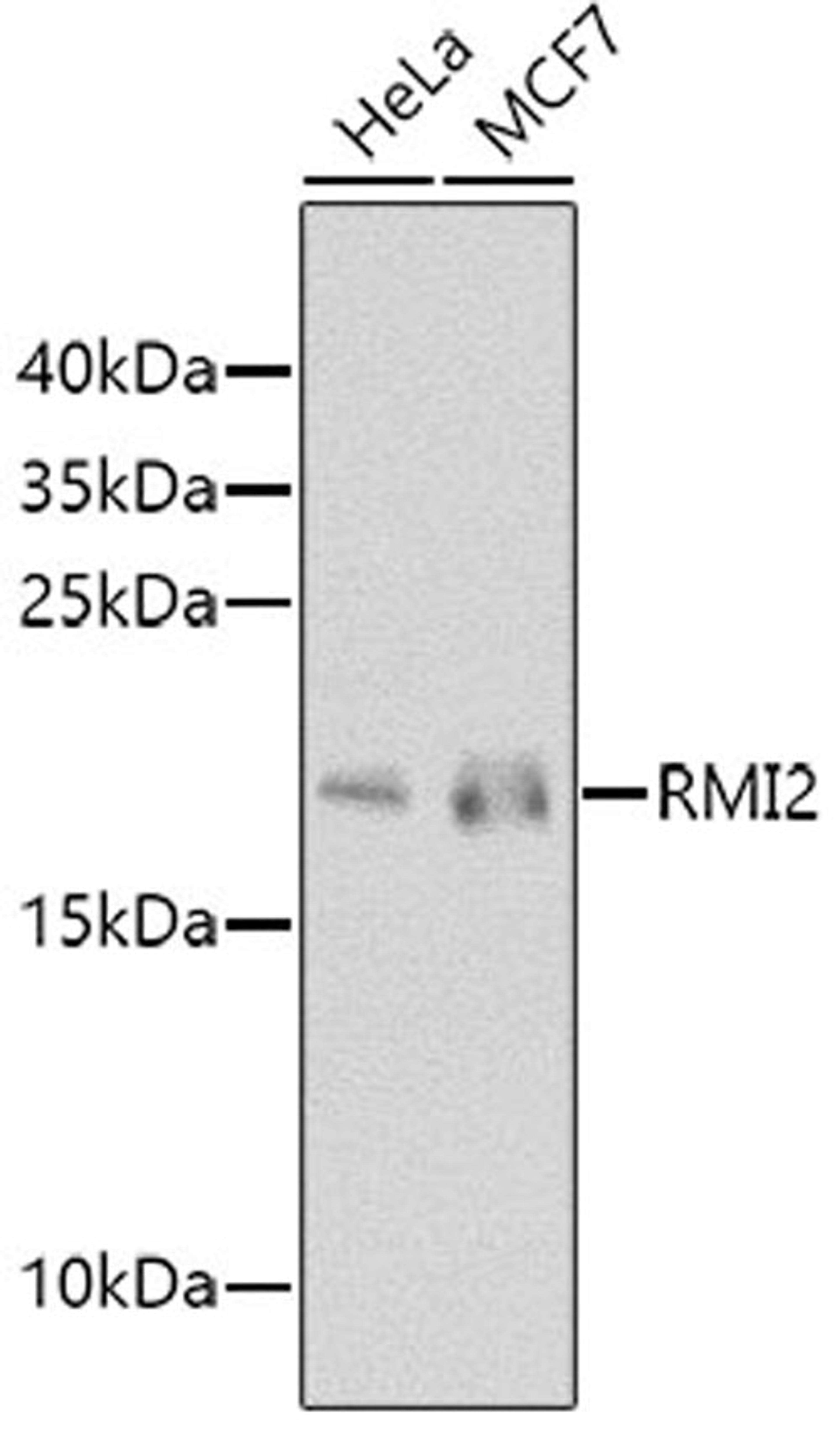 Western blot - RMI2 antibody (A8523)