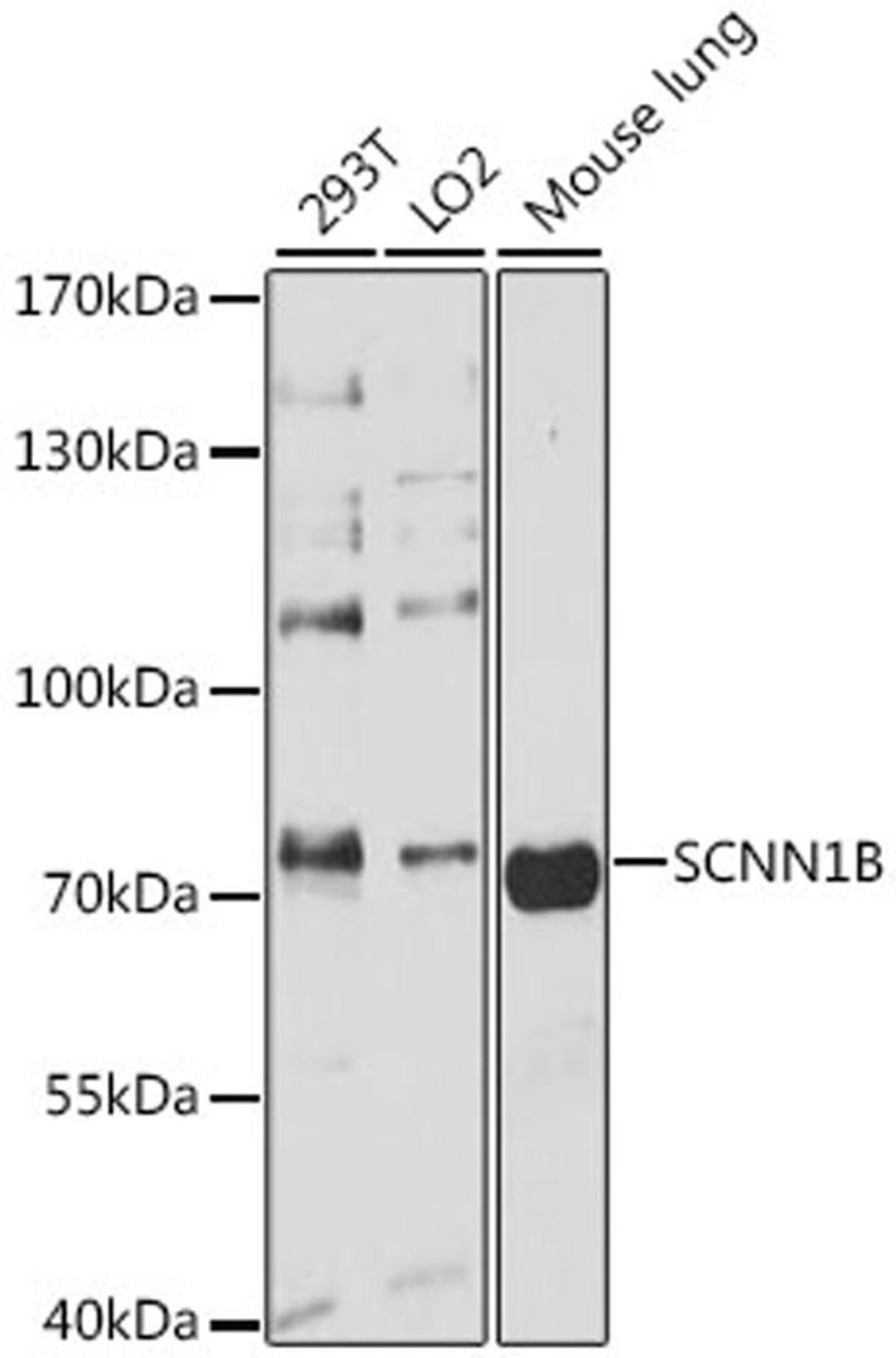 Western blot - SCNN1B antibody (A1765)