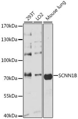 Western blot - SCNN1B antibody (A1765)