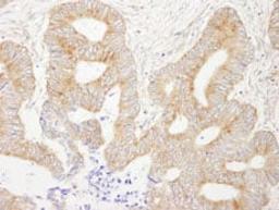 Detection of human AKAP1 by immunohistochemistry.