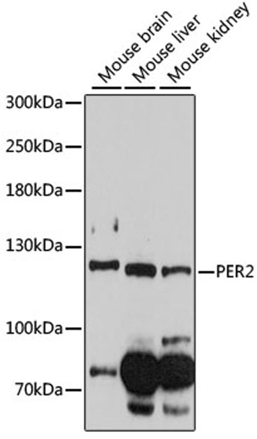 Western blot - PER2 antibody (A14080)