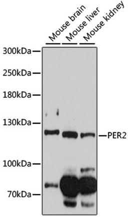 Western blot - PER2 antibody (A14080)