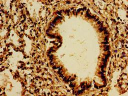 Immunohistochemistry of paraffin-embedded human lung tissue using CSB-PA019053LA01HU at dilution of 1:100