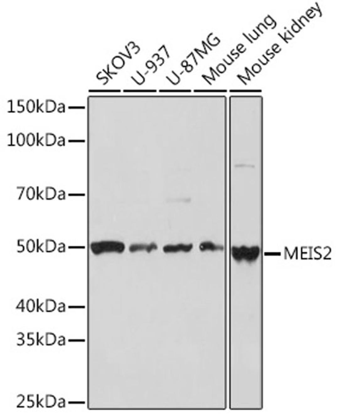 Western blot - MEIS2 Rabbit mAb (A3566)