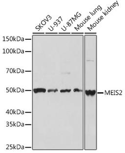 Western blot - MEIS2 Rabbit mAb (A3566)