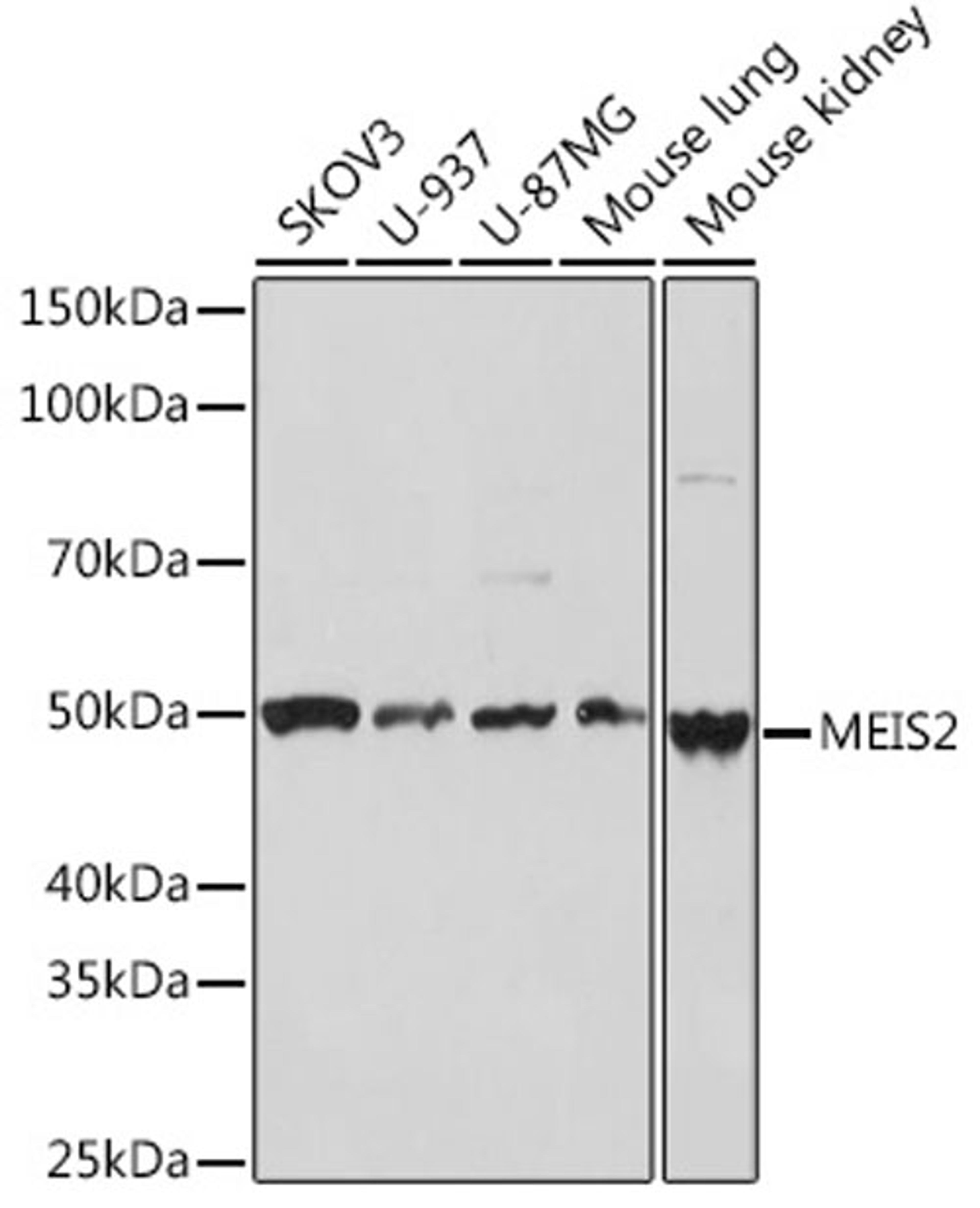 Western blot - MEIS2 Rabbit mAb (A3566)
