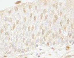 Detection of human MYBBP1a by immunohistochemistry.