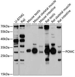 Western blot - POMC antibody (A3038)