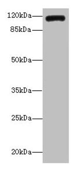 Western blot. All lanes: INVS antibody IgG at 14ug/ml + K562 whole cell lysate. Secondary. Goat polyclonal to rabbit IgG at 1/10000 dilution. Predicted band size: 118, 100, 11 kDa. Observed band size: 118 kDa.