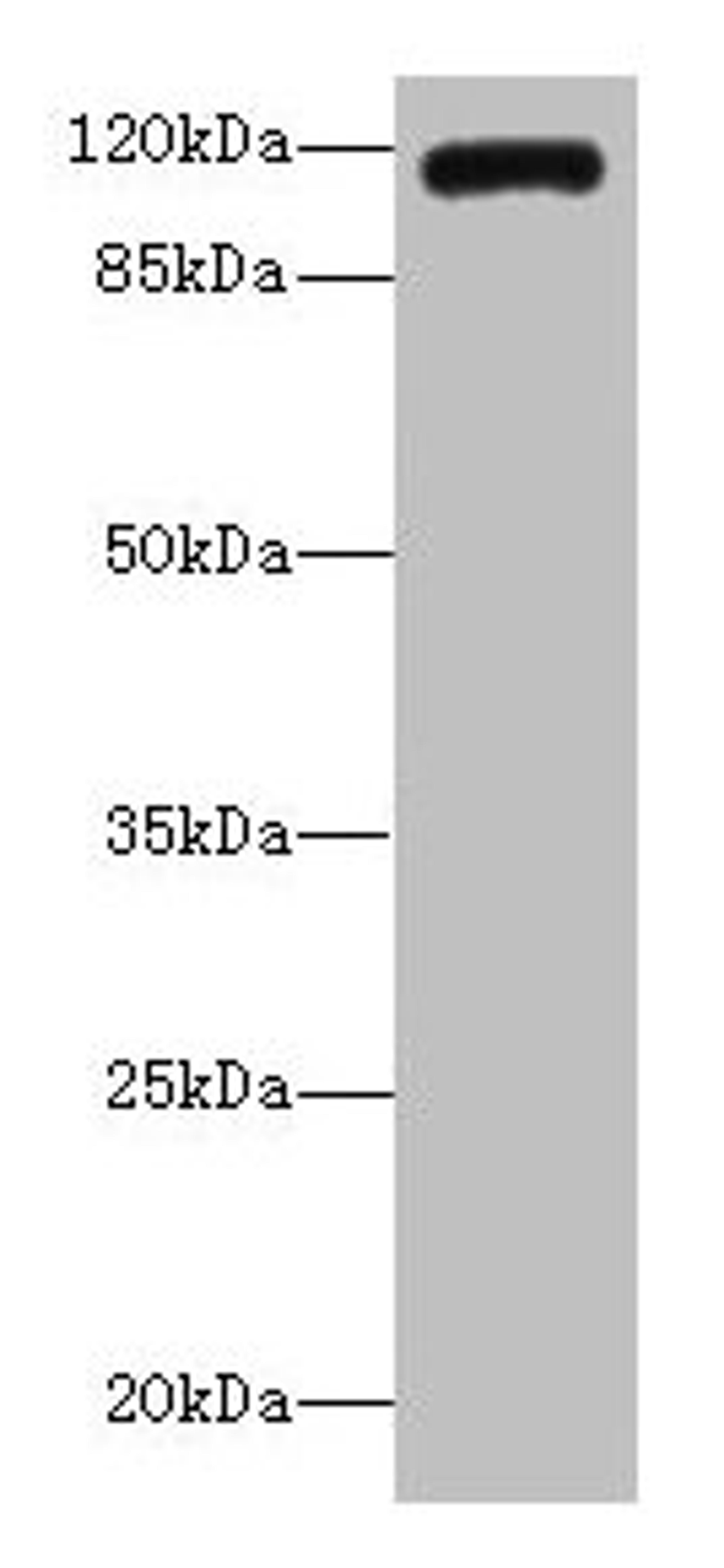 Western blot. All lanes: INVS antibody IgG at 14ug/ml + K562 whole cell lysate. Secondary. Goat polyclonal to rabbit IgG at 1/10000 dilution. Predicted band size: 118, 100, 11 kDa. Observed band size: 118 kDa.
