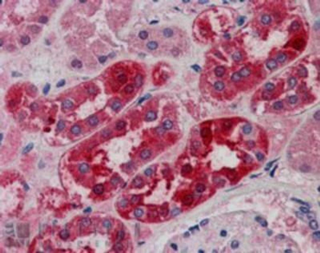 Immunohistochemistry-Paraffin: MID2 Antibody [NB100-1167] - Analysis of Human Kidney using this antibody at 5 ug/ml. Steamed antigen retrieval with citrate buffer pH 6, AP-staining.