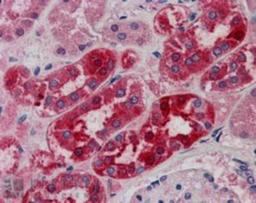 Immunohistochemistry-Paraffin: MID2 Antibody [NB100-1167] - Analysis of Human Kidney using this antibody at 5 ug/ml. Steamed antigen retrieval with citrate buffer pH 6, AP-staining.