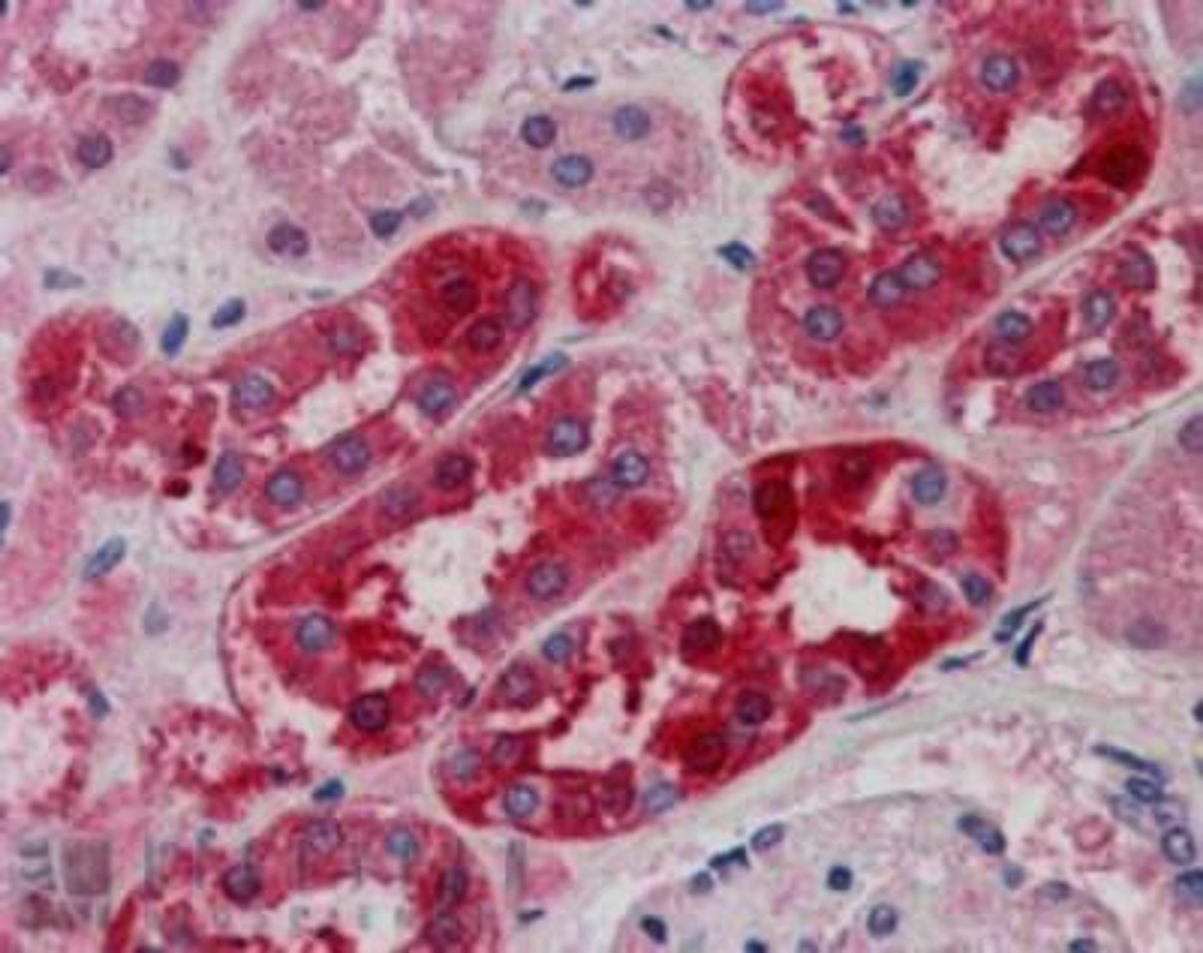 Immunohistochemistry-Paraffin: MID2 Antibody [NB100-1167] - Analysis of Human Kidney using this antibody at 5 ug/ml. Steamed antigen retrieval with citrate buffer pH 6, AP-staining.