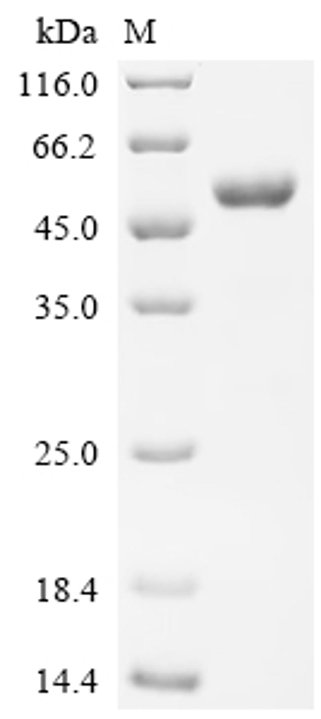 (Tris-Glycine gel) Discontinuous SDS-PAGE (reduced) with 5% enrichment gel and 15% separation gel.
