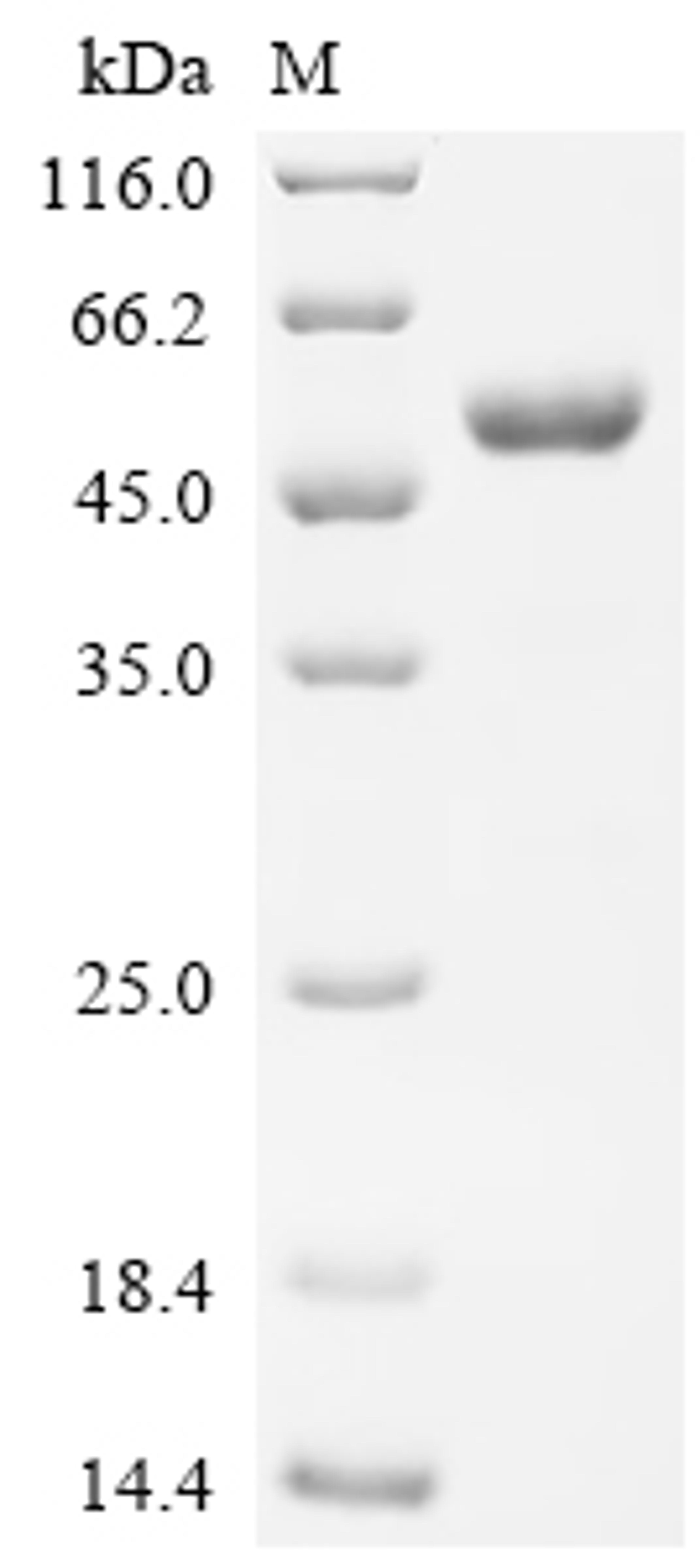 (Tris-Glycine gel) Discontinuous SDS-PAGE (reduced) with 5% enrichment gel and 15% separation gel.