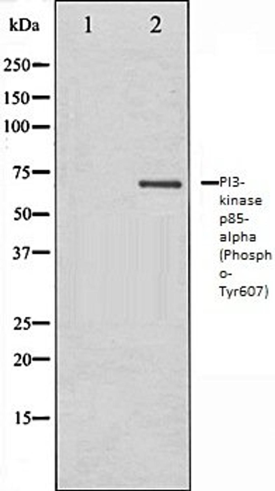 Western blot analysis of Rat kidney tissue lysates using PI3-kinase p85- alpha (Phospho-Tyr607) antibody, The lane on the left is treated with the antigen-specific peptide.