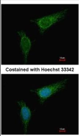 Immunocytochemistry/Immunofluorescence: BCKDHA Antibody [NBP2-15552] - Immunofluorescence analysis of methanol-fixed HeLa, using antibody at 1:500 dilution.