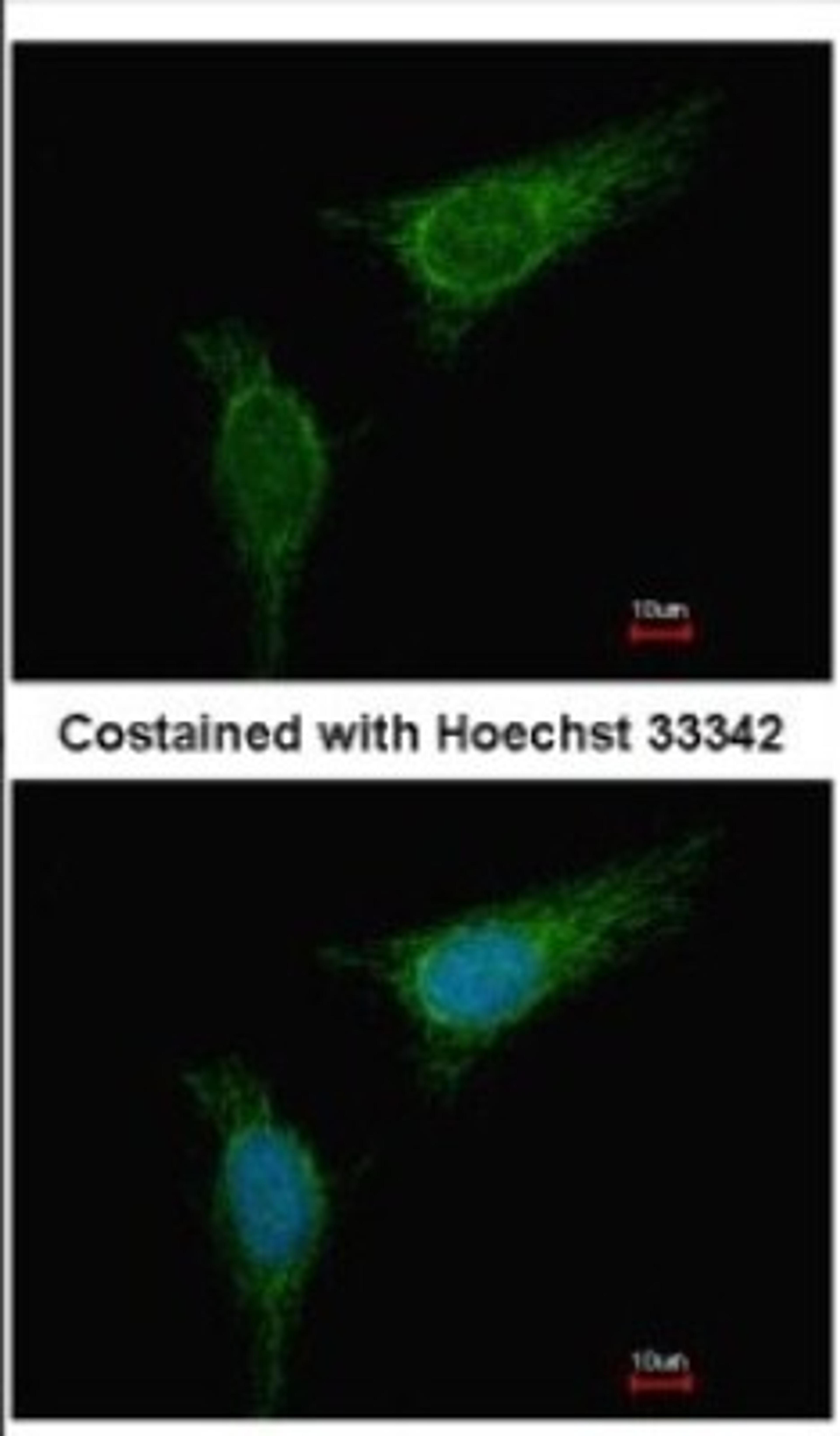 Immunocytochemistry/Immunofluorescence: BCKDHA Antibody [NBP2-15552] - Immunofluorescence analysis of methanol-fixed HeLa, using antibody at 1:500 dilution.