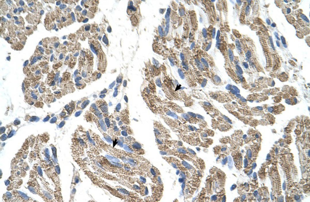 Antibody used in IHC on Human Muscle.