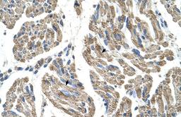 Antibody used in IHC on Human Muscle.