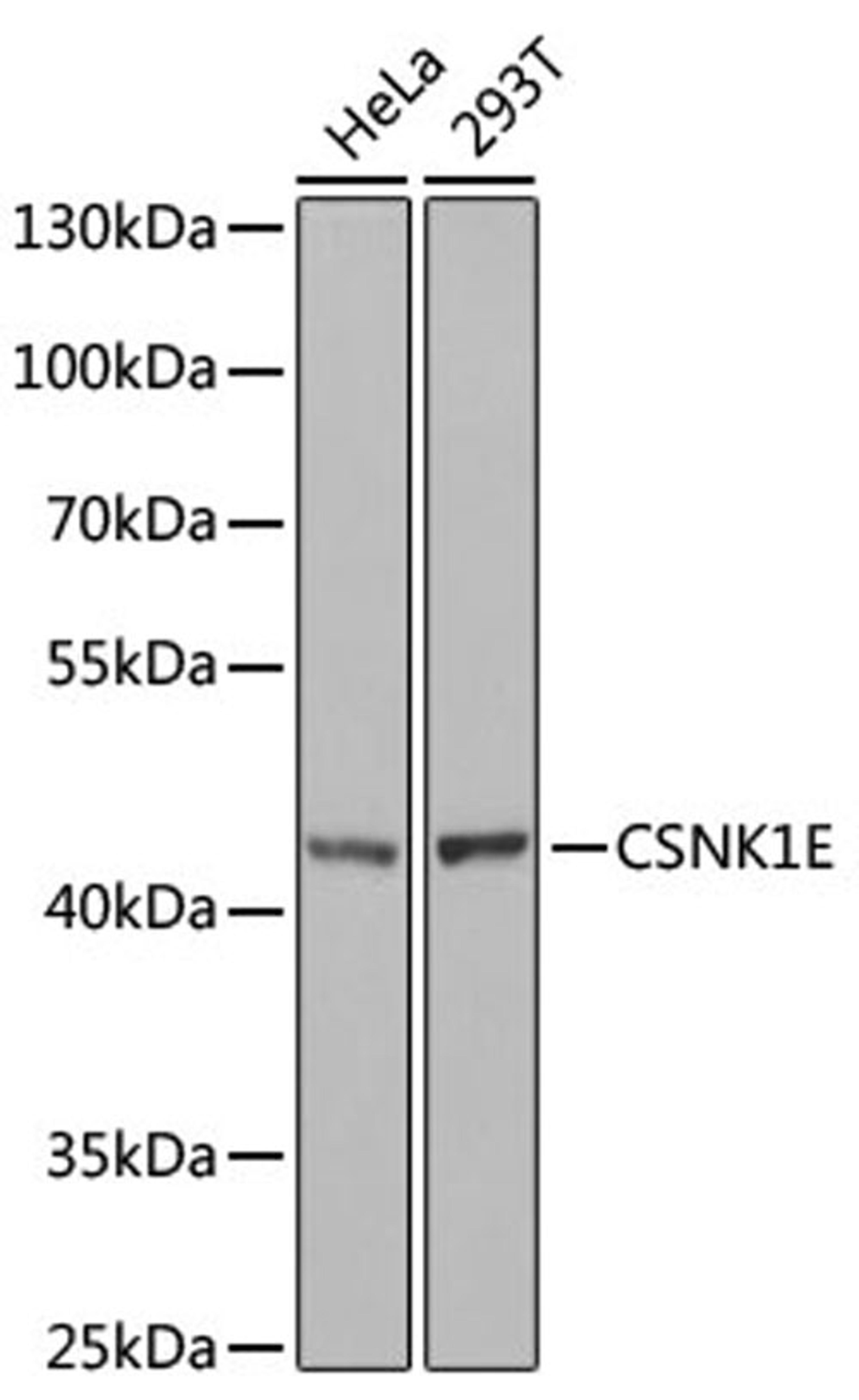 Western blot - CSNK1E antibody (A1796)