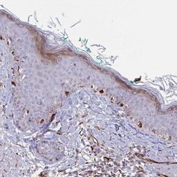 Immunohistochemistry: DCBLD1 Antibody [NBP2-32487] - Staining of human skin shows strong cytoplasmic positivity in melanocytes.