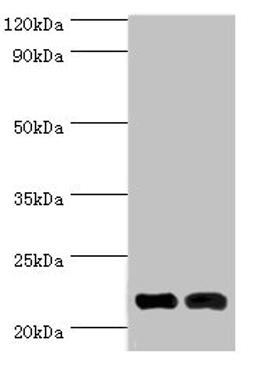 Western blot. All lanes: Neuronal calcium sensor 1 antibody at 10ug/ml. Lane 1: Hela whole cell lysate. Lane 2: Rat kidney tissue. Secondary. Goat polyclonal to rabbit IgG at 1/10000 dilution. Predicted band size: 22, 20 kDa. Observed band size: 22 kDa. 