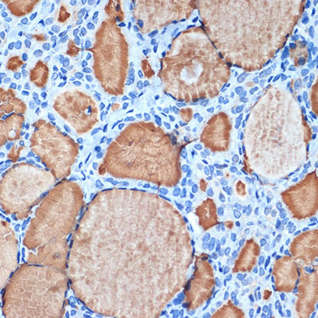 Immunohistochemistry - Thyroglobulin Rabbit mAb (A3409)
