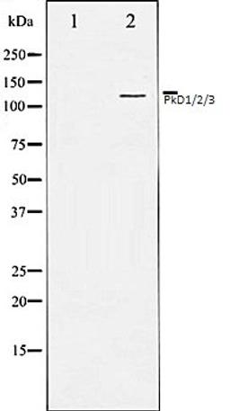 Western blot analysis of Jurkat whole cell lysates using PKD1/2/3/PKC ? antibody, The lane on the left is treated with the antigen-specific peptide.