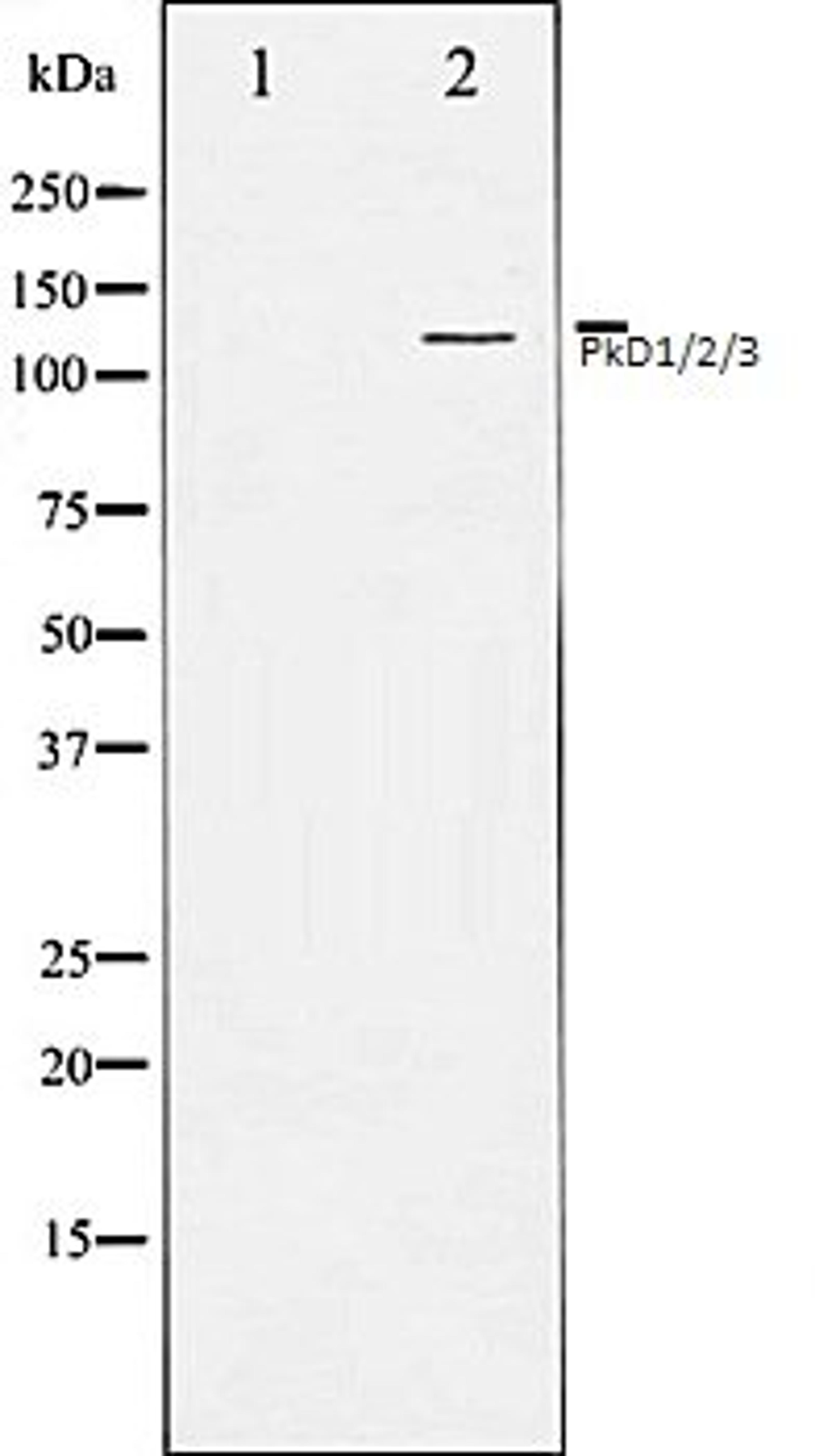 Western blot analysis of Jurkat whole cell lysates using PKD1/2/3/PKC ? antibody, The lane on the left is treated with the antigen-specific peptide.