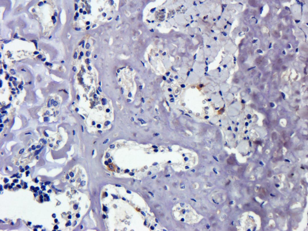 IHC-P image of rat bone marrow tissue using BCL2 antibody (2.5 ug/ml)