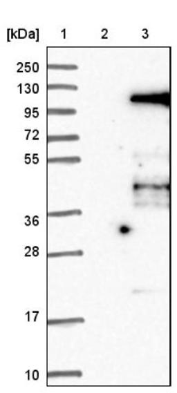 Western Blot: Elongin A Antibody [NBP1-87040] - Lane 1: Marker [kDa] 250, 130, 95, 72, 55, 36, 28, 17, 10<br/>Lane 2: Negative control (vector only transfected HEK293T lysate)<br/>Lane 3: Over-expression lysate (Co-expressed with a C-terminal myc-DDK tag (~3.1 kDa) in mammalian HEK293T cells, LY418839)