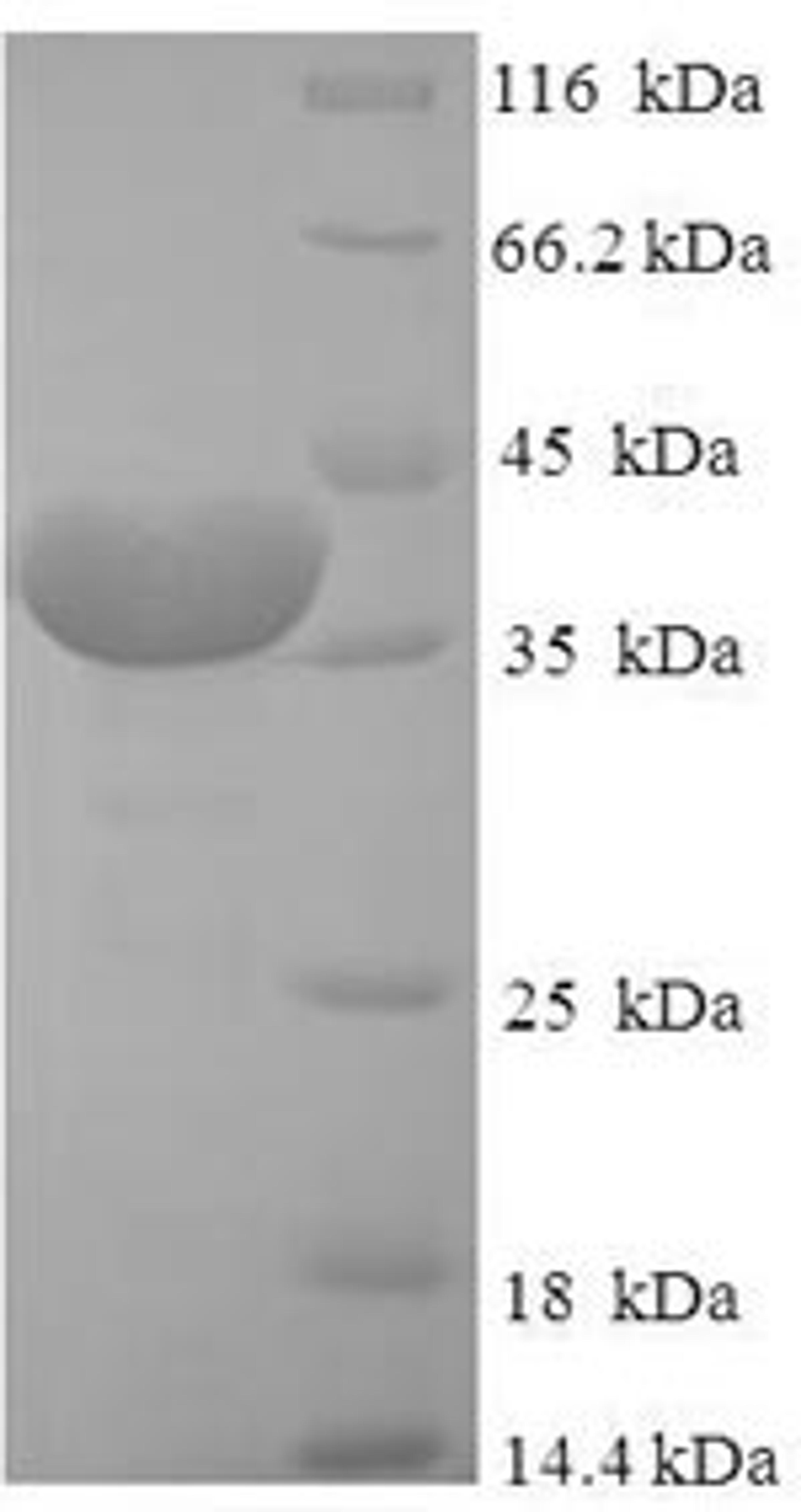 (Tris-Glycine gel) Discontinuous SDS-PAGE (reduced) with 5% enrichment gel and 15% separation gel.