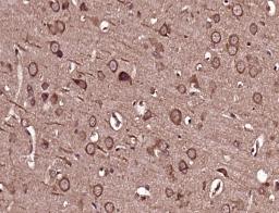 Immunohistochemical staining of rat brain tissue using MICALL2 antibody