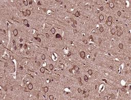 Immunohistochemical staining of rat brain tissue using MICALL2 antibody