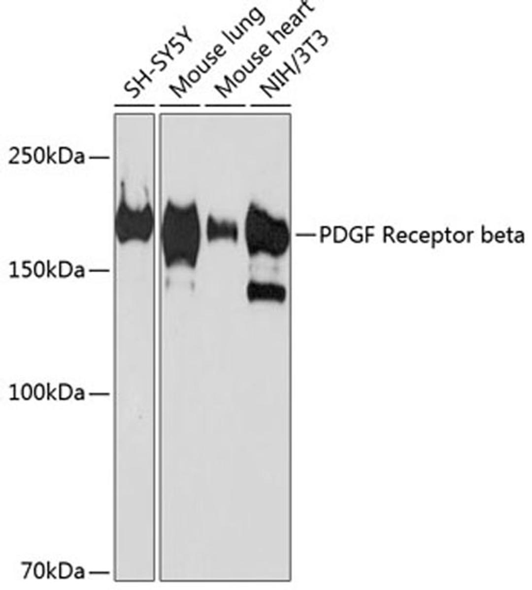 Western blot - PDGF Receptor beta antibody (A19531)