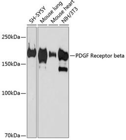 Western blot - PDGF Receptor beta antibody (A19531)