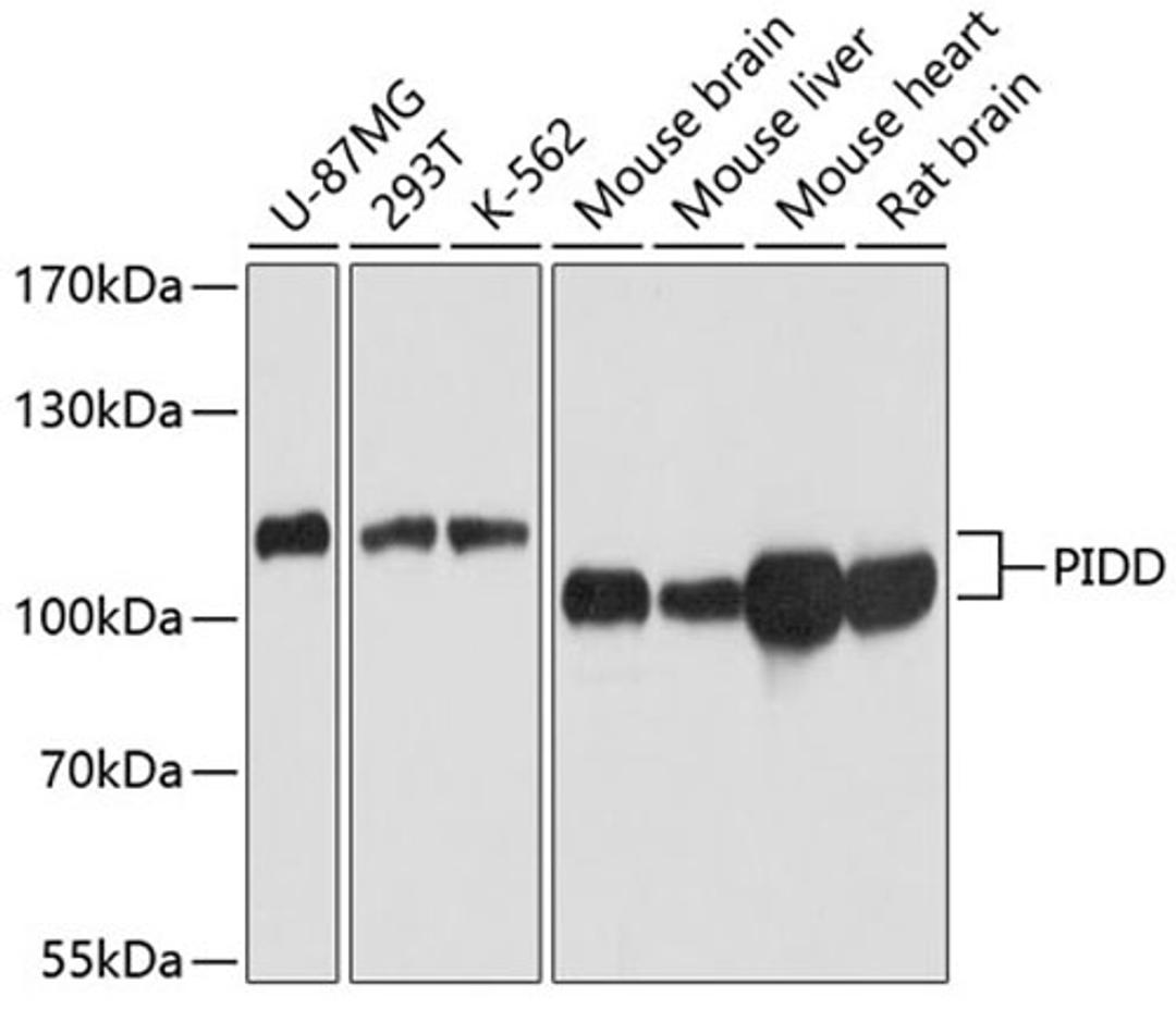 Western blot - PIDD antibody (A4831)